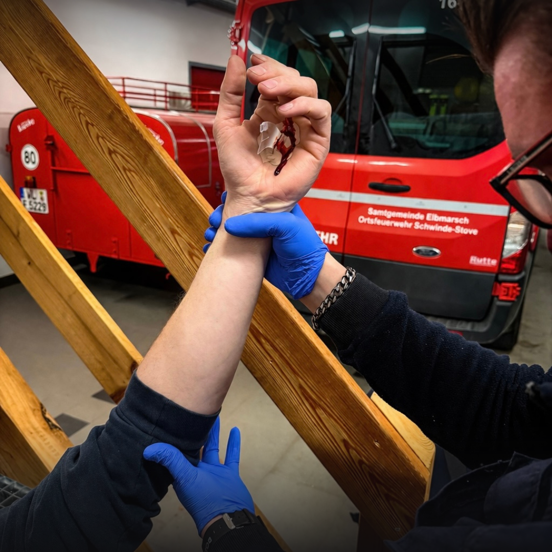 Eine Handverletzung wird versorgt